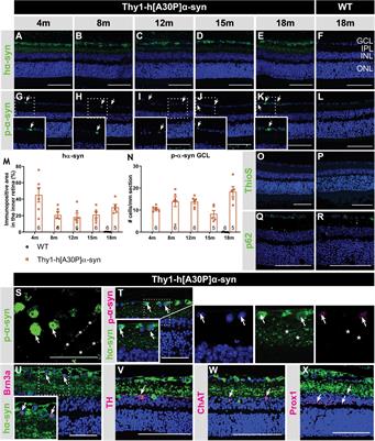 Characterizing the Retinal Phenotype of the Thy1-h[A30P]α-syn Mouse Model of Parkinson’s Disease